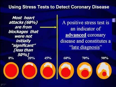 Heart Stress Test Results: What They Mean .